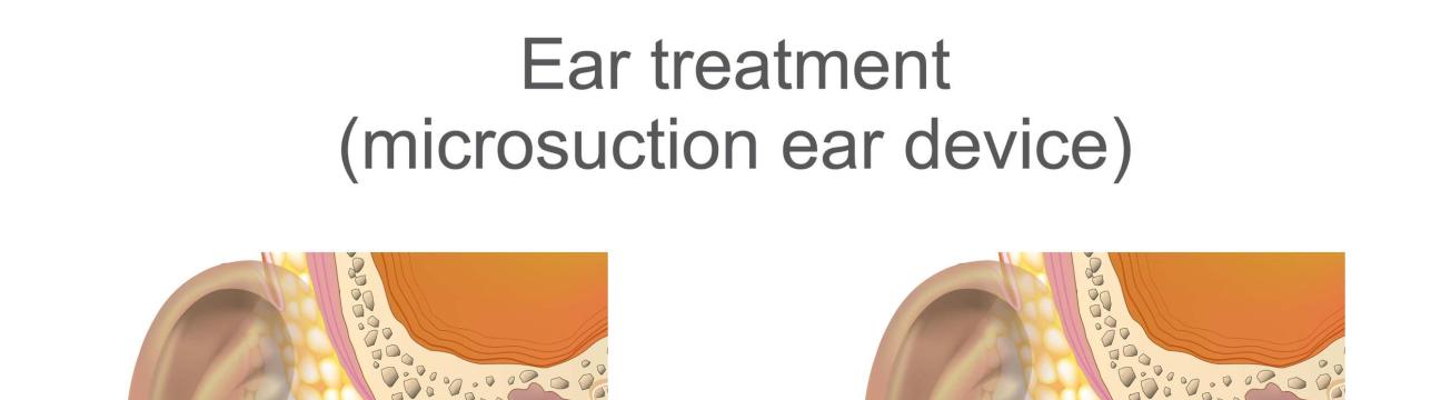 GloucestEar HealthClinic